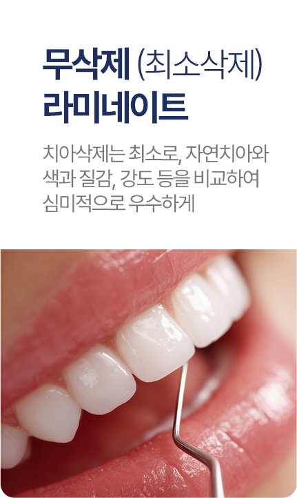 무삭제 (최소삭제) 라미네이트